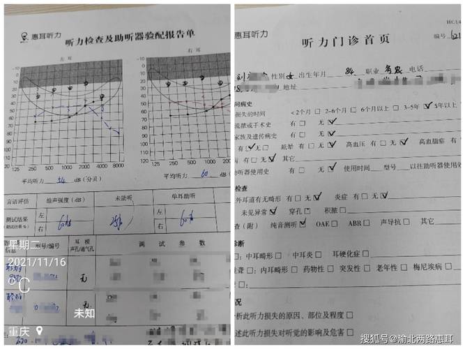 拿到听力检查报告，应该怎么看