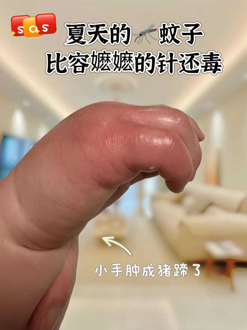 蚊虫入耳怎么办,这样处理更安心 家电资讯