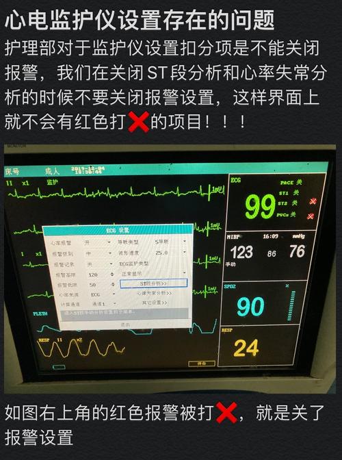 心电记录仪常见故障